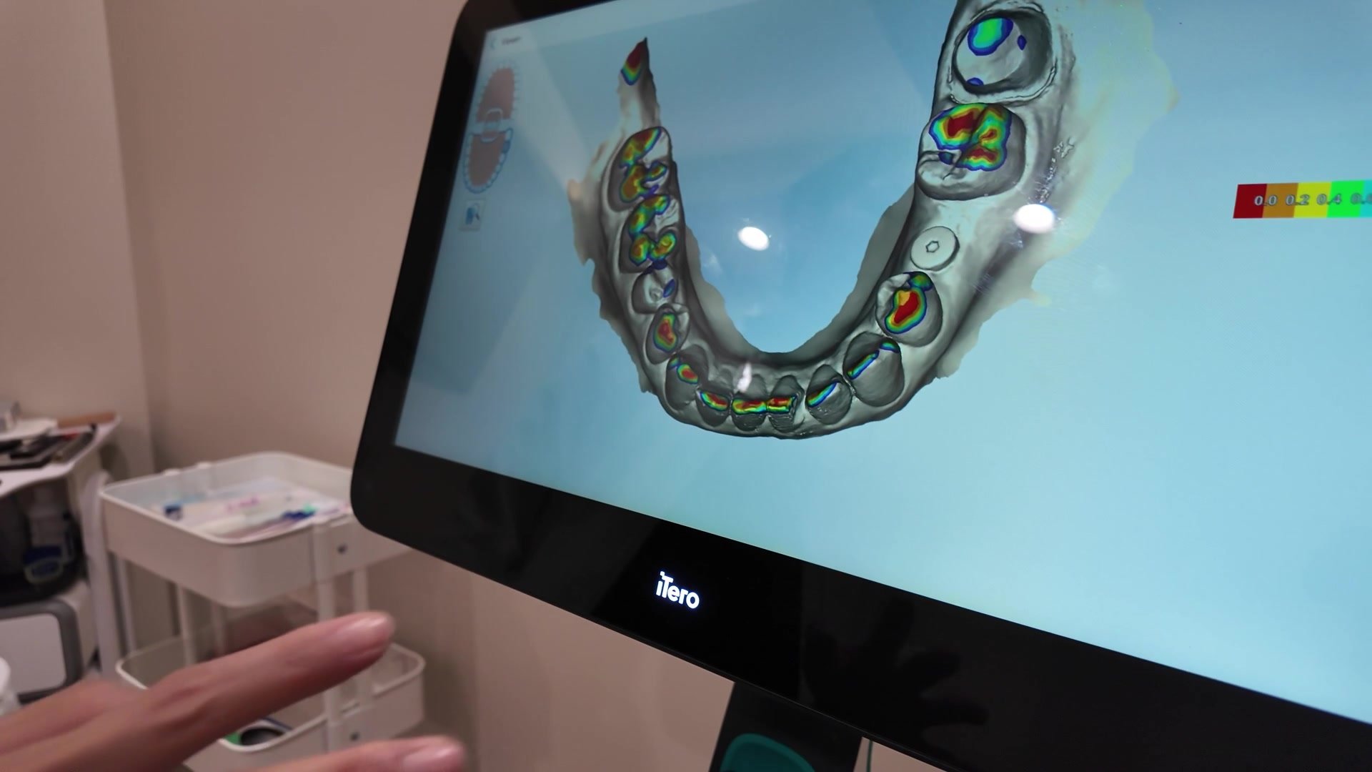 A hand turning a 3D scan of a dental arch on the screen